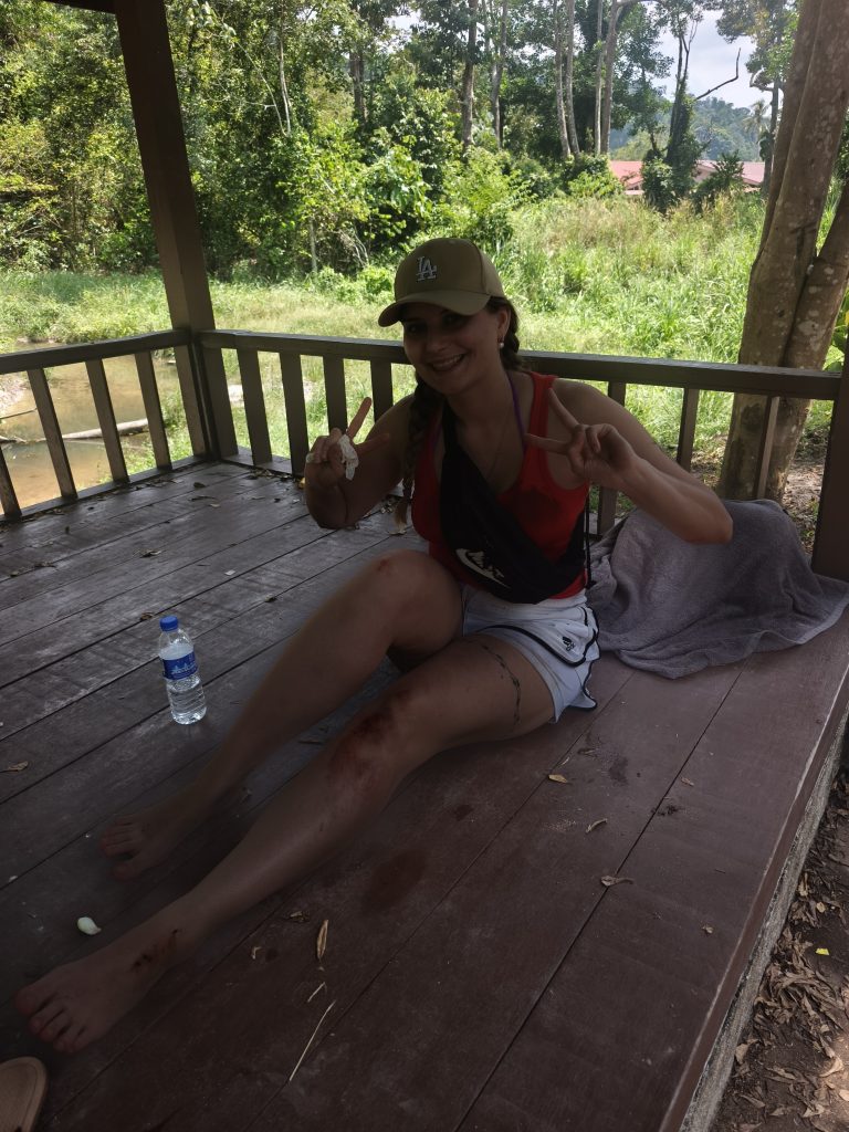 Madlen Trefzer kurz nach einem Moped-Unfall in Malaysia; auf der Insel Pulau Pangkor